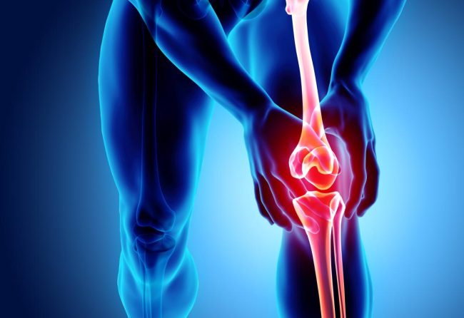 KNEE-1577888285
