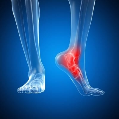 foot-pain_1200x1200-400×400